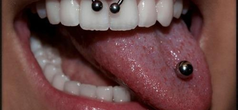 Piercing orali e brillantini dentali: quali sono i rischi e come vanno trattati