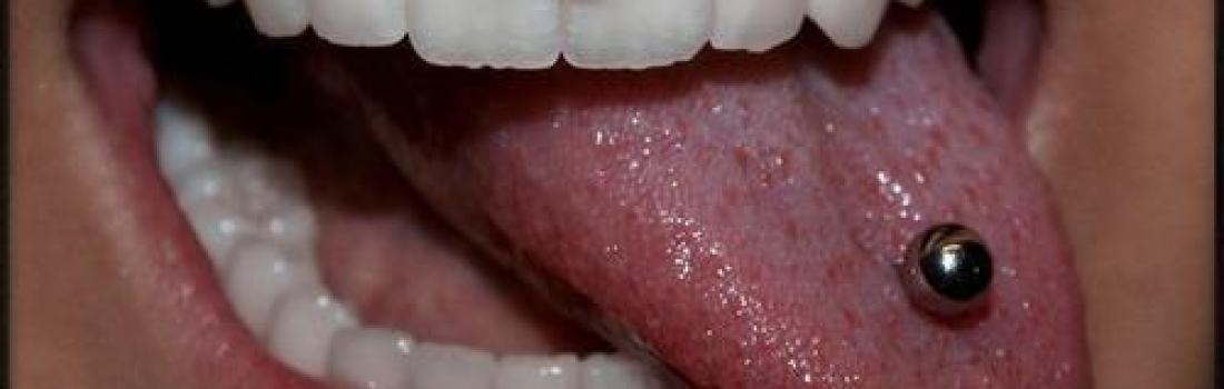 Piercing orali e brillantini dentali: quali sono i rischi e come vanno trattati