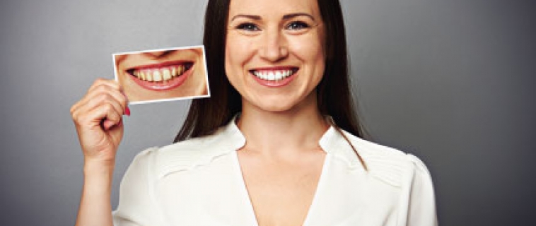 Servizi Dentali Estetici
