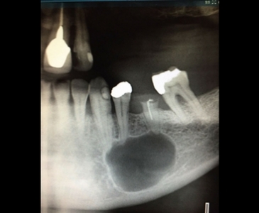 Chirurgia Orale e Maxillofacciale